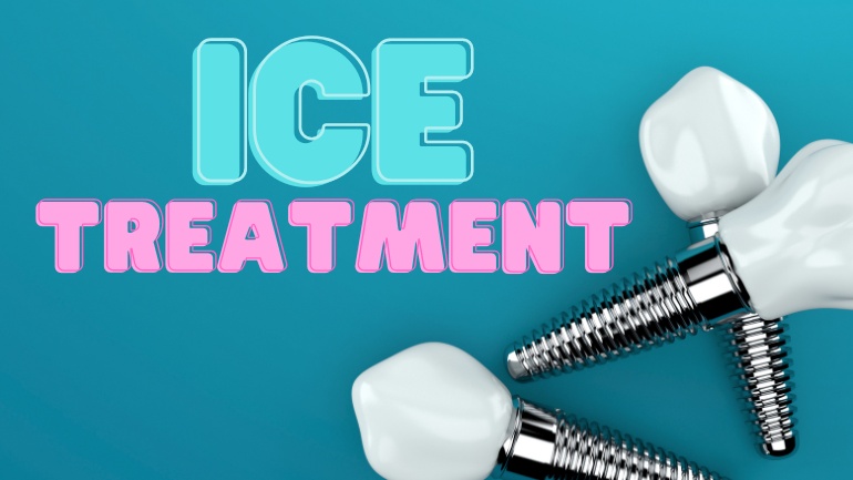 How Long Does Ice Treatment Take After Implant?