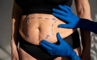 Liposuction (Fat Removal) Turkey