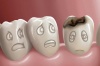 Tips for Protecting Your Teeth from Decay