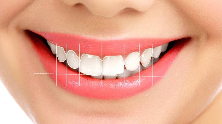 What is Smile Design and How to Apply It?